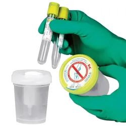 Veiligheidsurineopvangsysteem Veiligheidsurinebeker, niet-steriel met deksel, met etiket* | 120 ml